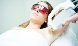Does Laser Hair Removal Work?