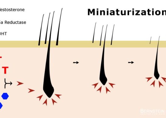 Foods That Block DHT Naturally: Dermatologist-Approved Diet for Hair Loss